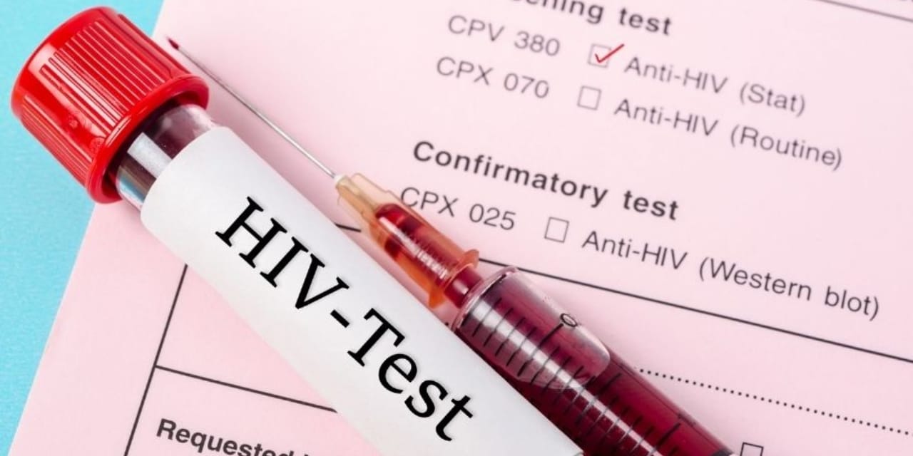 HIV pozitif olduğunu eşinden saklayan adama hapis cezası