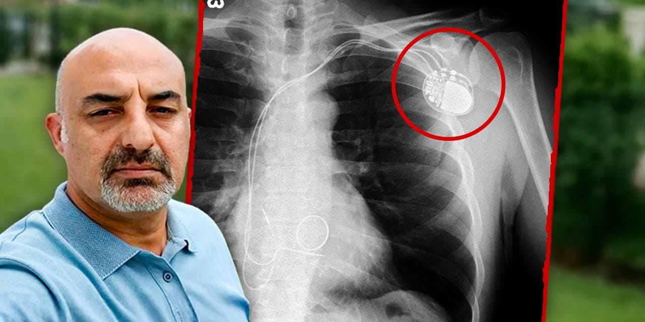 İBB tutuklusunun kalp pili kaydı: "Hayati tehlike var cezaevinde kalamaz"