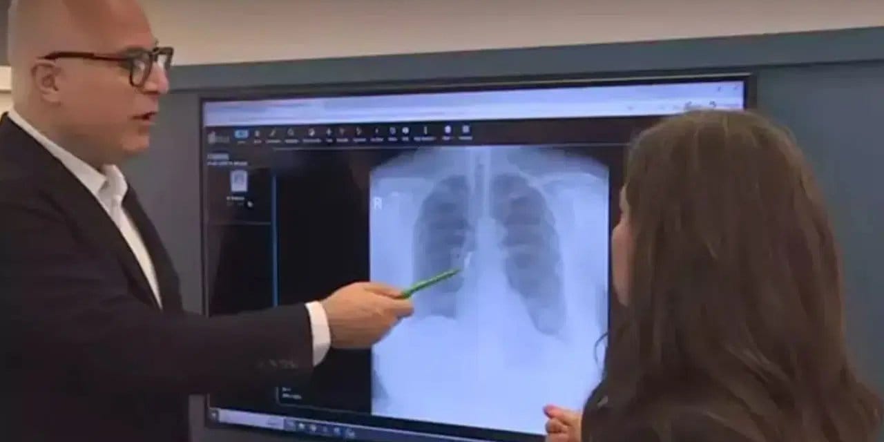 Dişleri akciğerinden çıktı