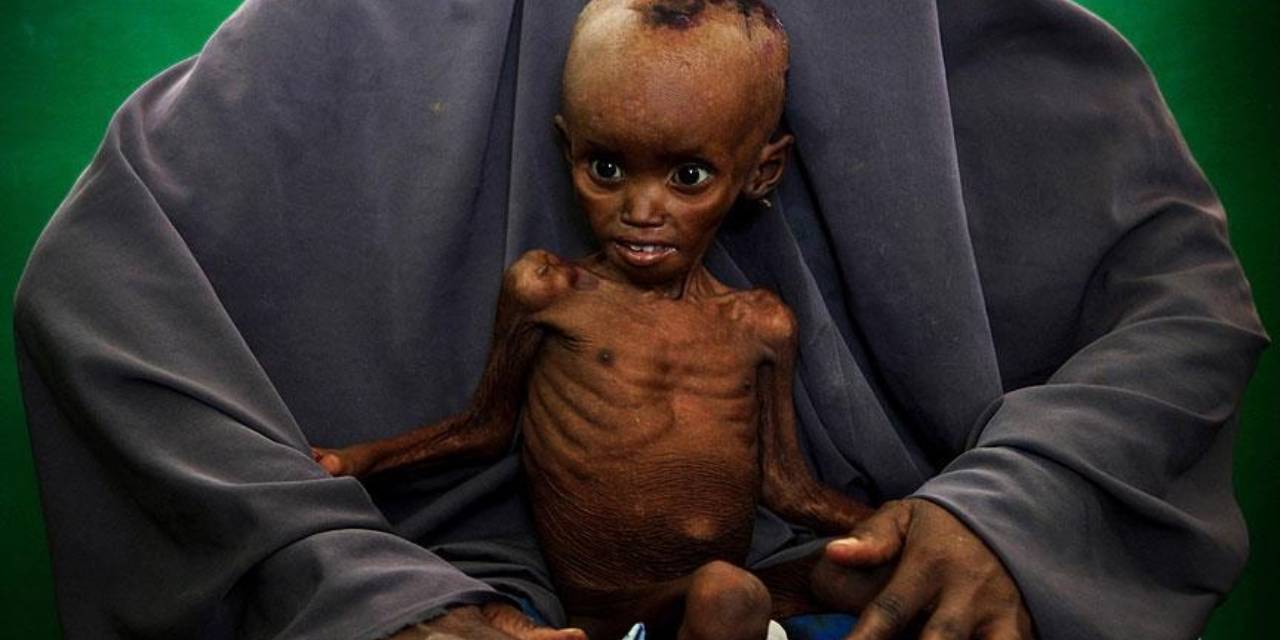 Somali alarm veriyor: 4,4 Milyon kişi açlıkla karşı karşıya