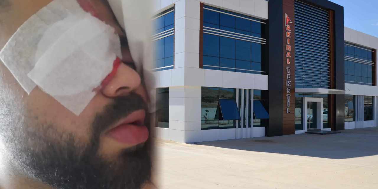 200 liralık koruyucu gözlük verilmeyen işçi yüzde 80 kör kaldı!