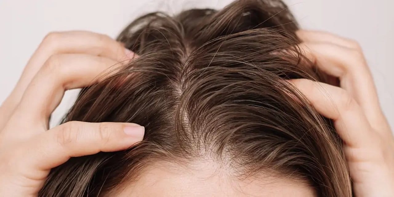 "Saçım kaşınıyor" diyenlere yeni reçete: Bir kaşık şeker