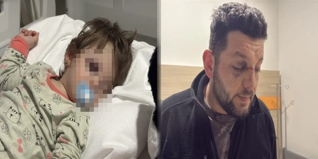 Baba ile 14 aylık bebeği darbedilmişti! Şüphelilerin ifadesi ortaya çıktı