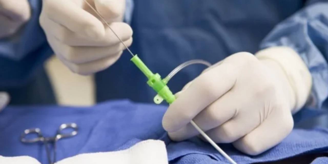 Anjiyodan ölüme Bakanlık risk Adli Tıp hatalı işlem dedi