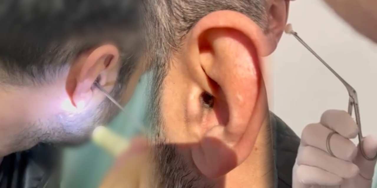 Polis şüphelenip durdurdu! Uyuşturucu kulağının içinden çıktı