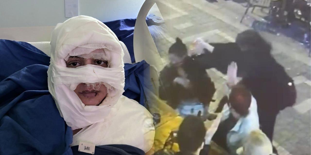 Kadıköy'de Gözde'yi ateşe vermişti! Kolonyalı saldırgan ilk kez konuştu