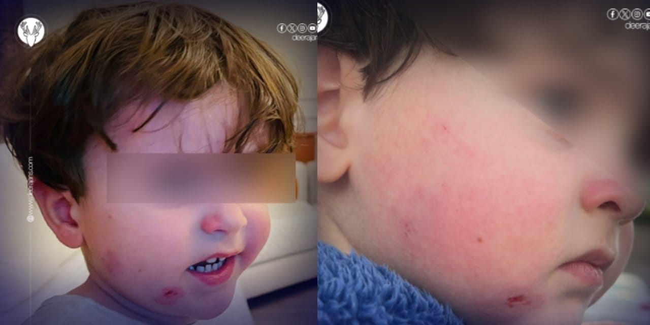 Özel kreşte 2.5 yaşındaki çocuğa darp iddiaları bir kenti salladı!