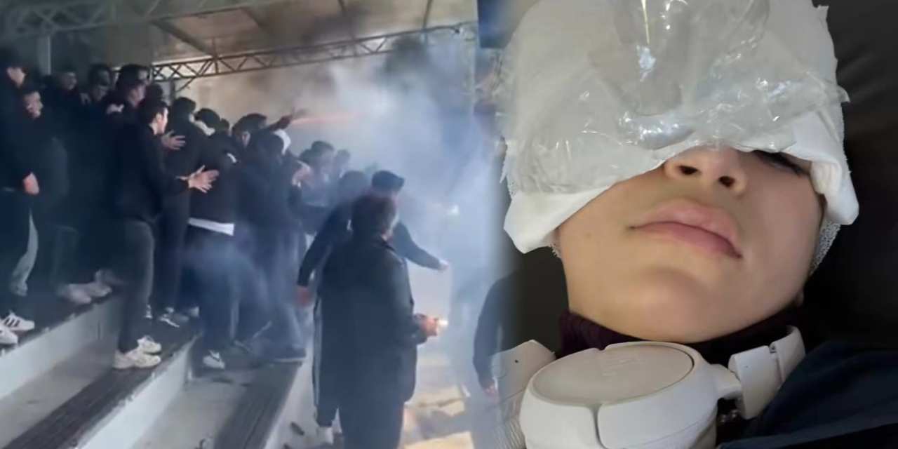 Futbol maçı kabusa döndü! Yakılan meşale kız çocuğunu yaraladı: Gözünde hasar oluştu