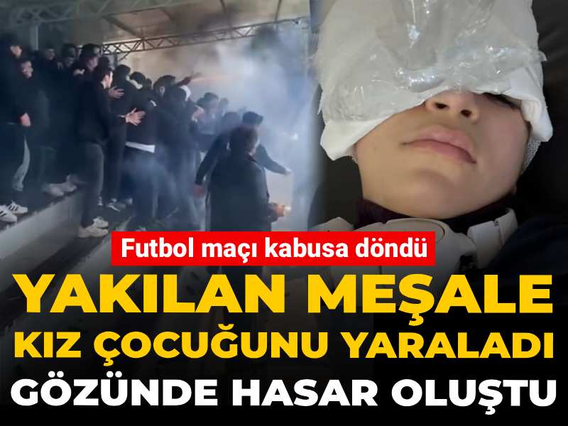 Futbol maçı kabusa döndü! Yakılan meşale kız çocuğunu yaraladı: Gözünde hasar oluştu
