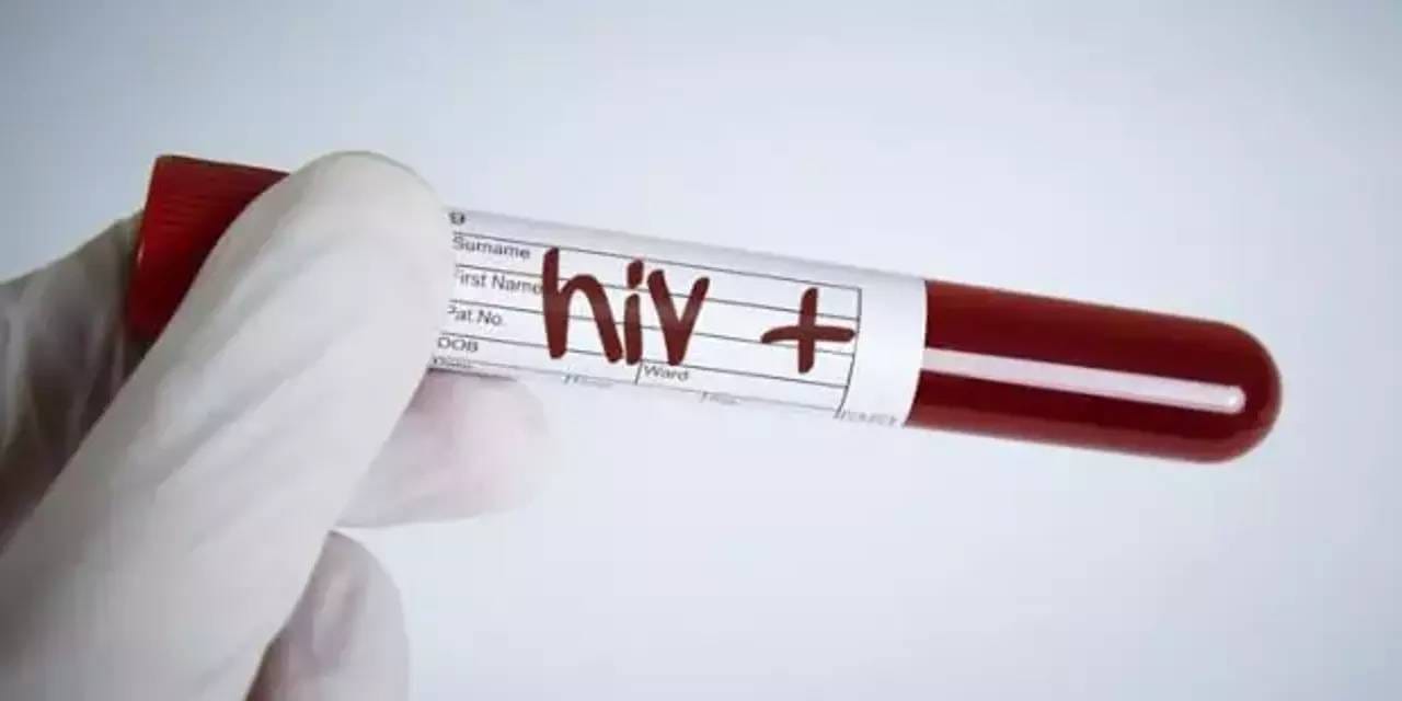 HIV vakalarında patlama yaşanmıştı! Altında yatan gerçek herkesi dehşete düşürdü