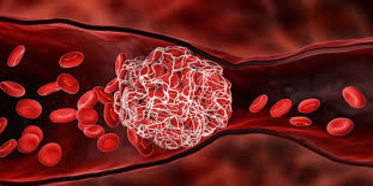 Pıhtı bir anda atmaz yıllarca yolunu gözler!