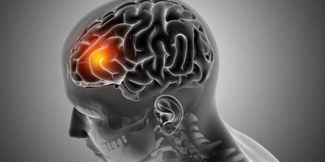 Yeni bir tedavi yolu başlıyor: Sinir onarımı artık mümkün mü?