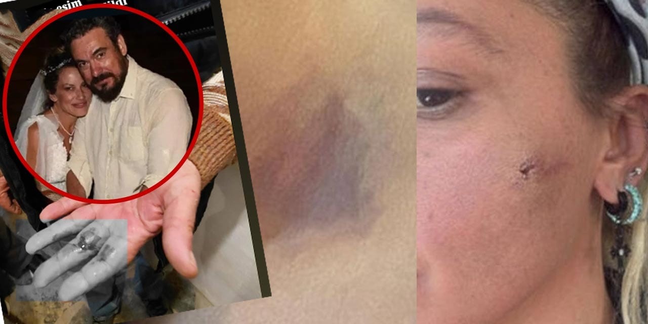Ünlü oyuncu Yıldız Asyalı yardım çağrısında bulundu: Önce beni sonra babamı darp etti