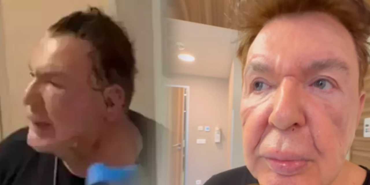 Kuşum Aydın son halini paylaştı! Yüzündeki şişlikler gündem olmuştu