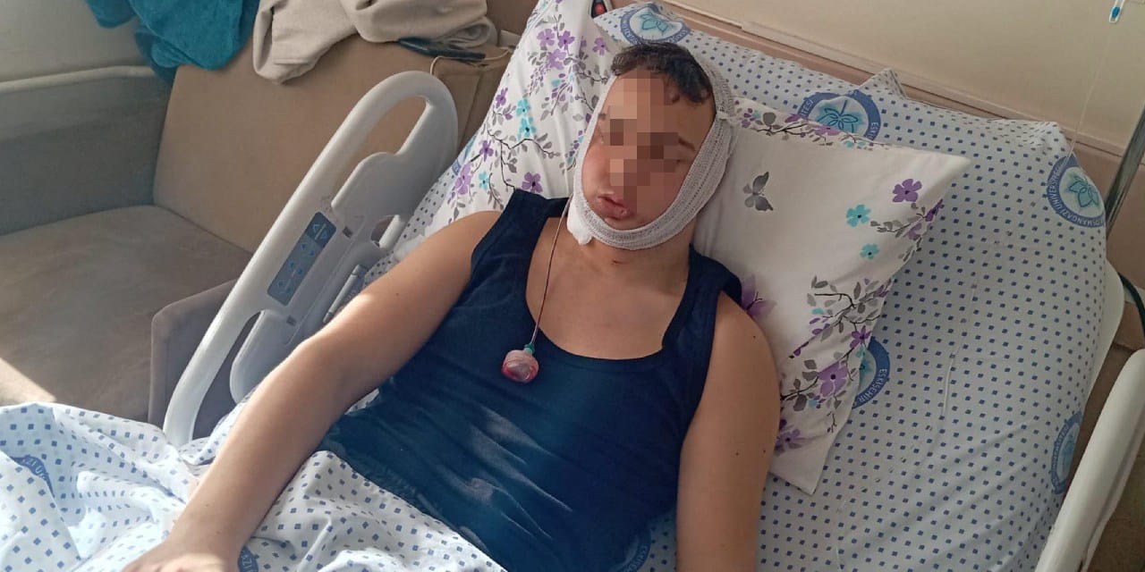 Liseli gencin çenesini kırmışlardı: 4 sanık ilk duruşmada tahliye oldu