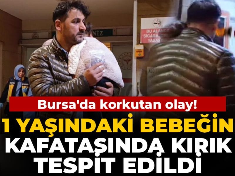 1 yaşındaki bebeğin kafatasında kırık tespit edildi