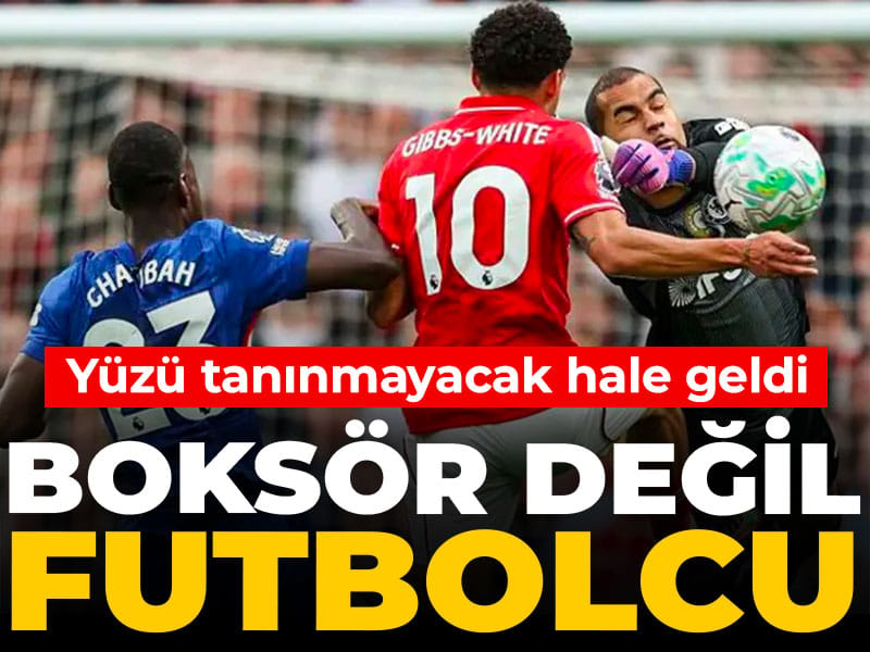 Bu pozisyondan sonra yüzü tanınmayacak hale geldi: Boksör değil futbolcu