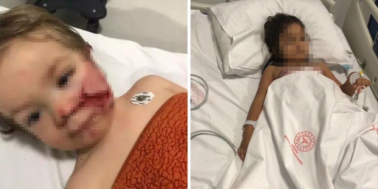 Ankara'da 2 kardeşe saldıran pitbullun sahibi tahliye edildi