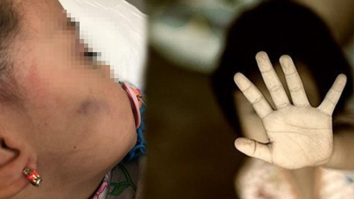 Dehşet veren olayın yaşandığı anaokulu kapatıldı