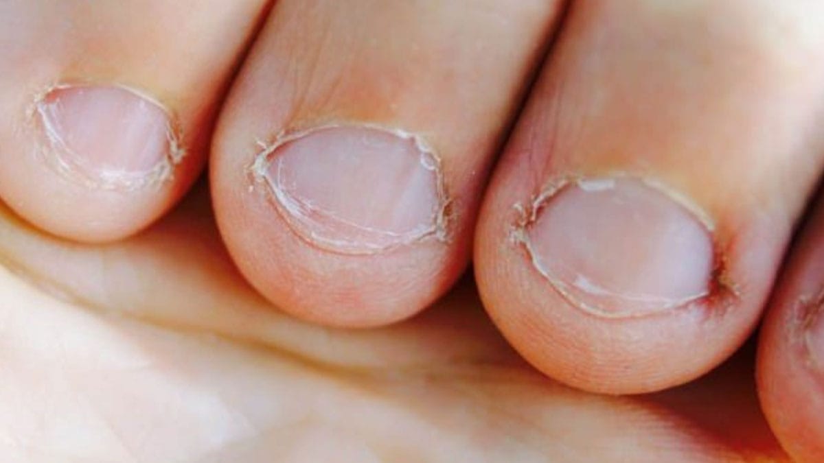 Anne-babalar dikkat: Çocuğunuz tırnaklarını yiyorsa sebebi bunlar olabilir