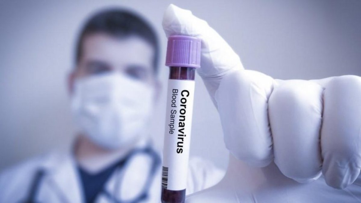 ABD, coronavirüs tedavisi için ilaç şirketiyle anlaştı