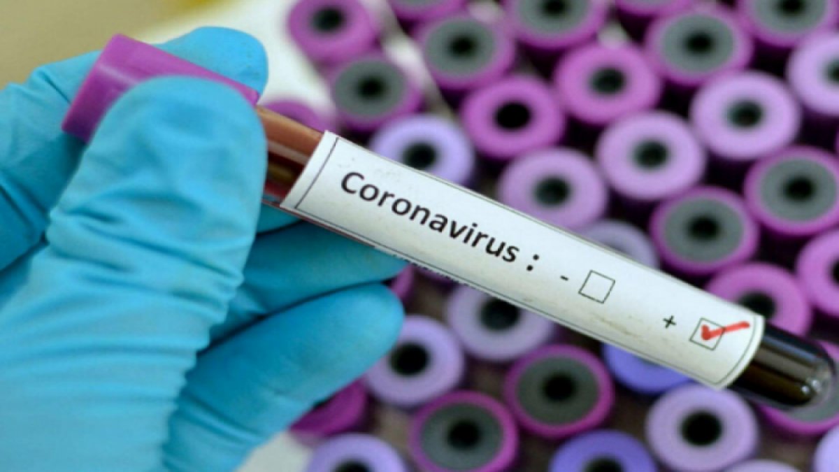 Fransa Kültür Bakanı Franck Riester, corona virüs'e yakalandı