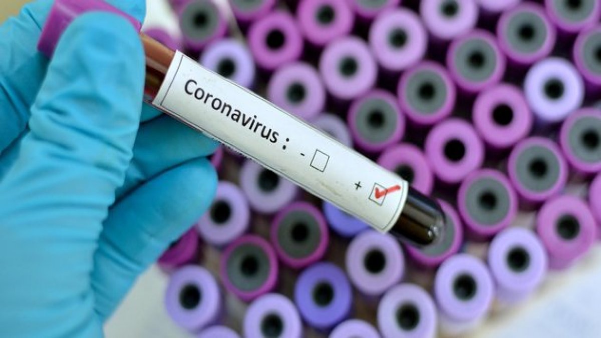Ukraynalı milletvekilinde coronavirüs tespit edildi