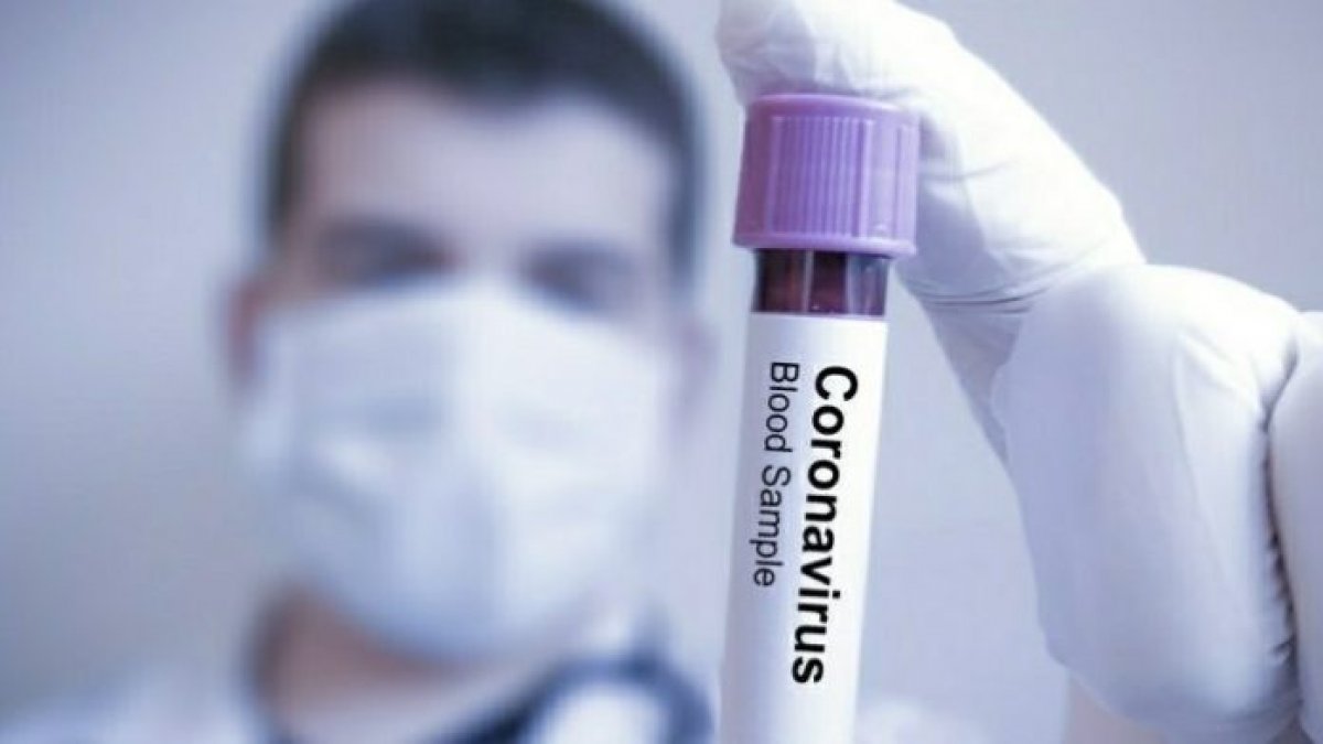 KHK'lı doktor 'coronavirüs' aşısı için göreve çağırılıyor