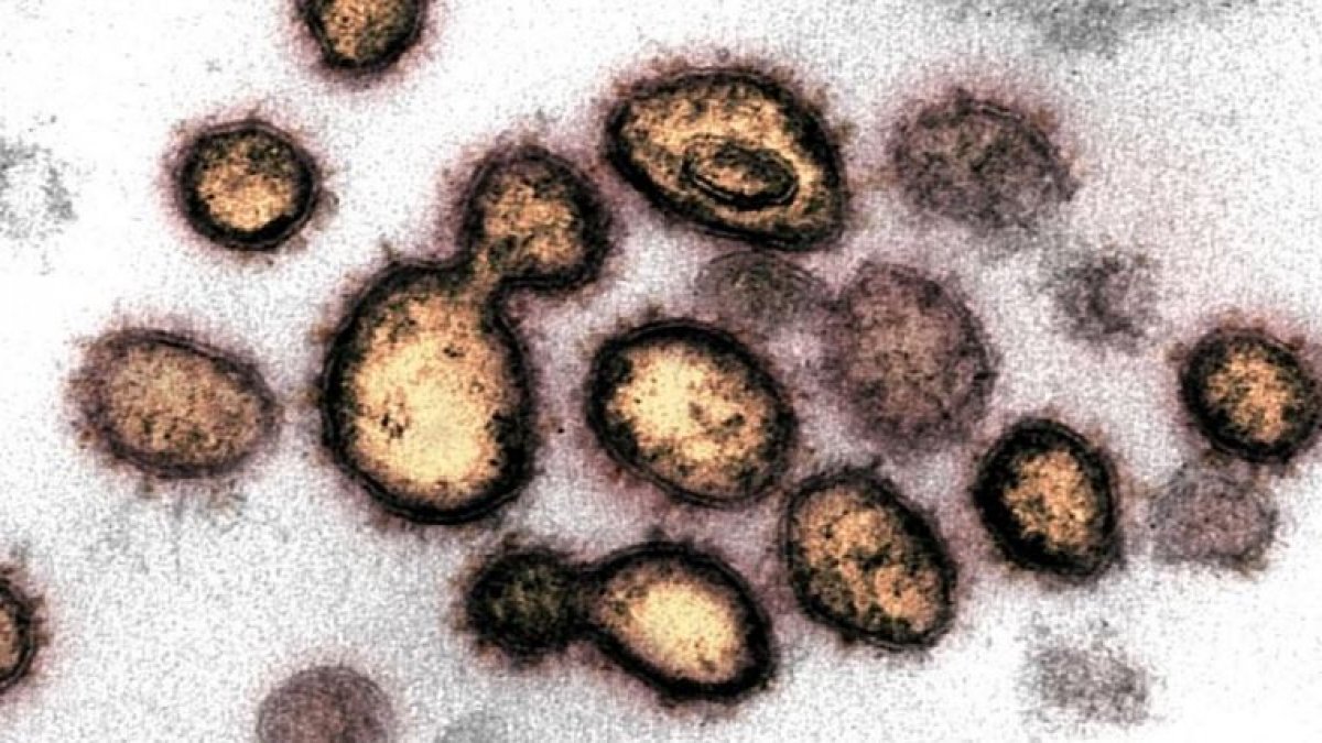 40 mutasyon geçirmiş virüs bulundu