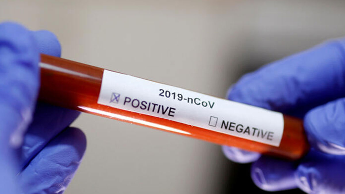 İngiltere'de test kitlerine coronavirüs bulaştı iddiası