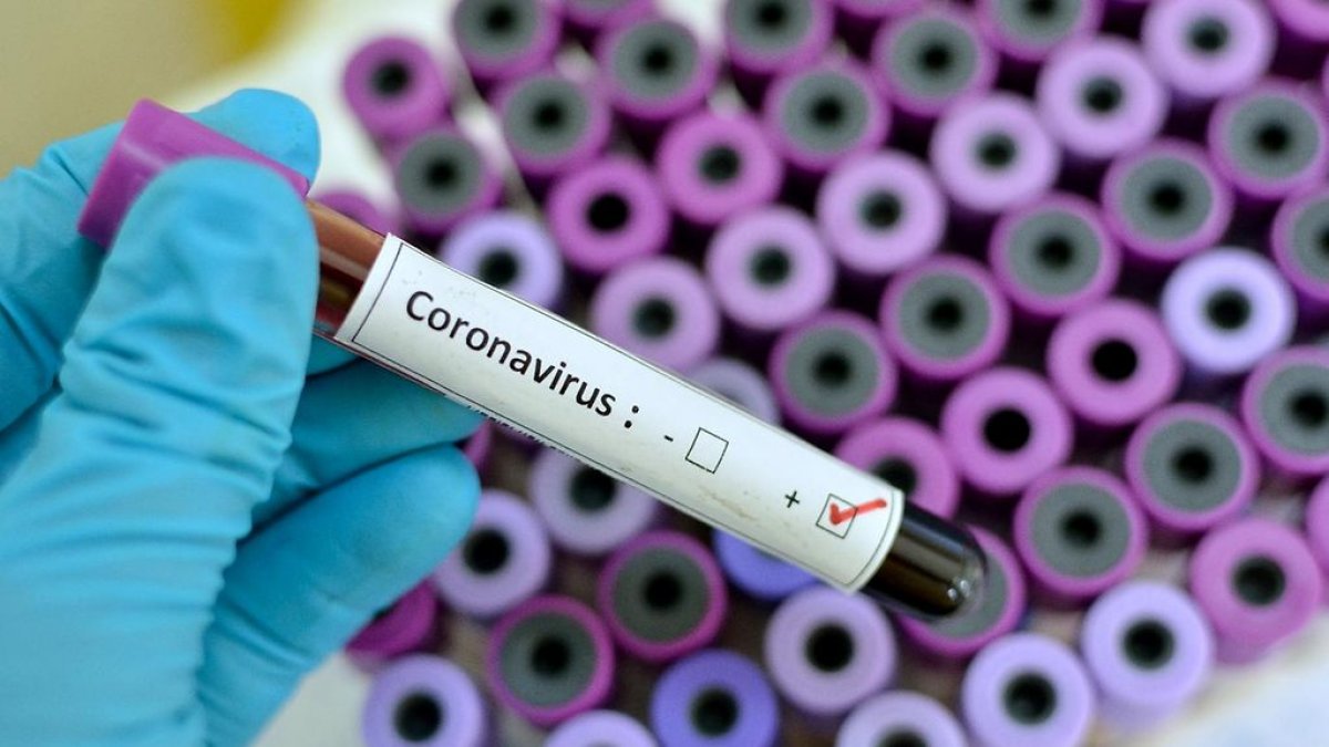 Coronavirüs testi yalnızca öksürüğü olana da yapılacak