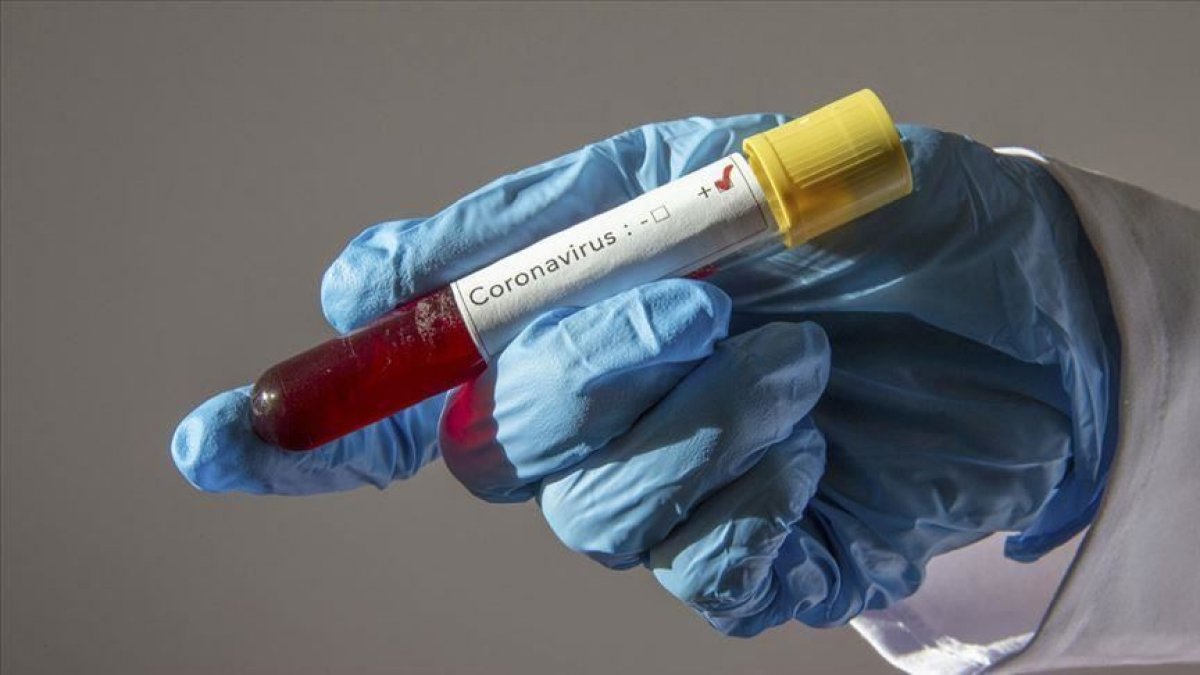 Koronavirüs salgınında dünya ve Türkiye'de son durum