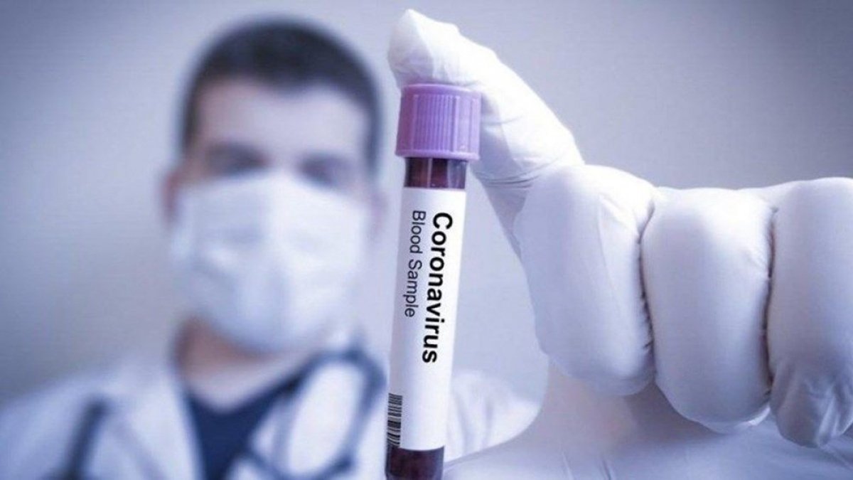 Bilim Kurulu Üyesi Yamanel: Kırılmayı sağlarsak virüsü kontrol altına alabiliriz