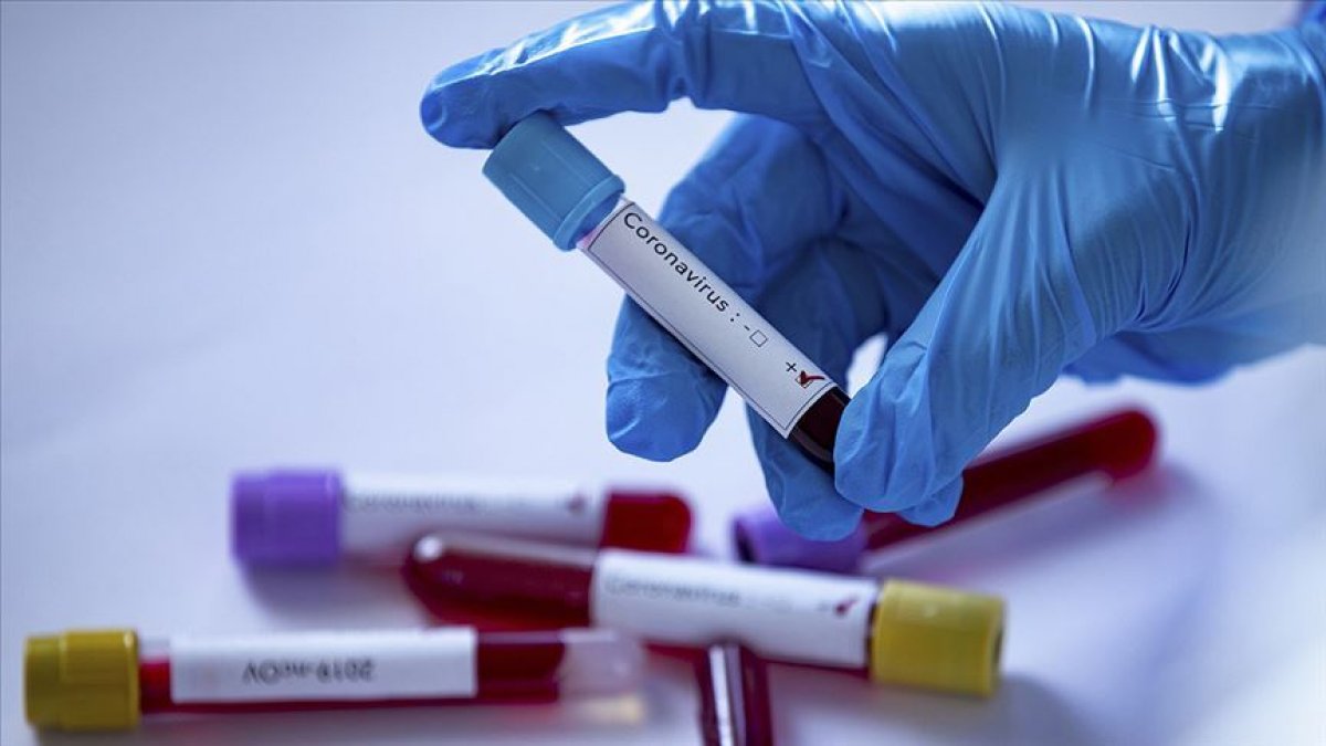 Koronavirüs ölümlerinde yeni bulgu: Sebebi farklı olabilir