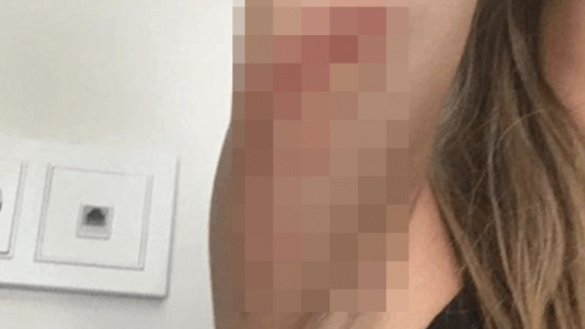 Tandoğan trafik kazası geçirdi