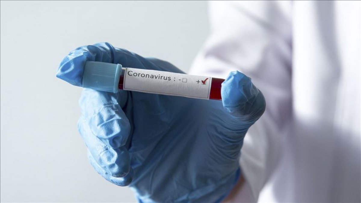 Sağlık Bakanlığından 'koronavirüs testleri' iddialarına yanıt