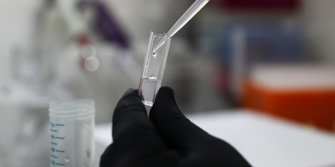 Kelebek hastalığı nedir, belirtileri nelerdir ve nasıl tedavi edilir?