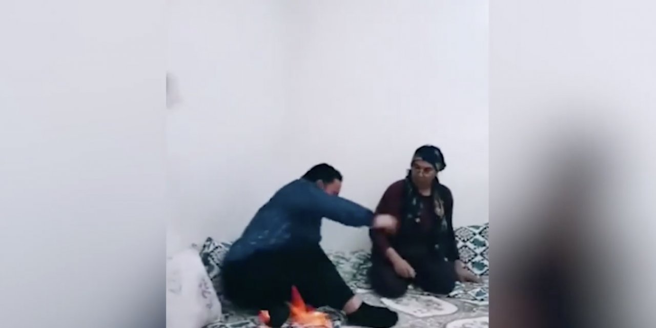 TikTok için elini yaktı!