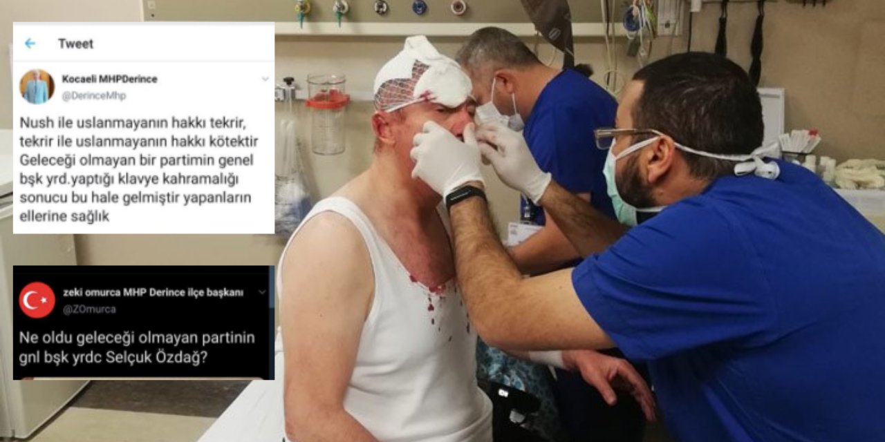 MHP İlçe Teşkilatı'ndan skandal tweeet: Yapanların eline sağlık