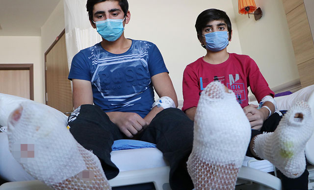 Taşıdıkları demir, yüksek gerilim hattına değince ayak tabanları patladı