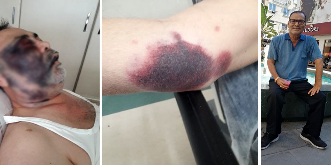 Park yeri kavgasında darp edilen engelli Mümin Kara yaşamını yitirdi