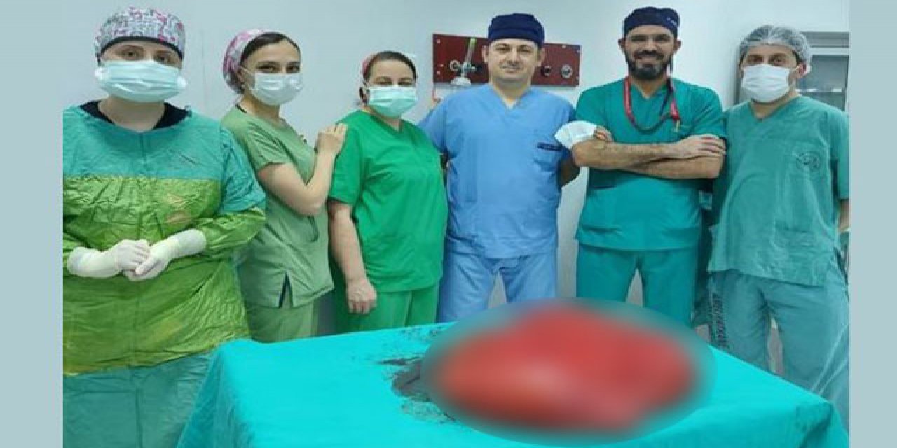 Gaz şikayetiyle hastaneye gitti: Karnından 21 kilo tümör çıkarıldı