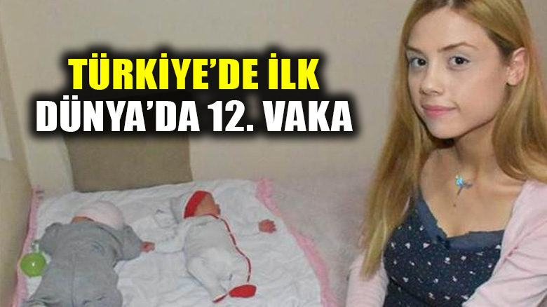 Türk tıp literatürüne geçen doğum: Bir ay arayla ikinci kez hamile kaldı