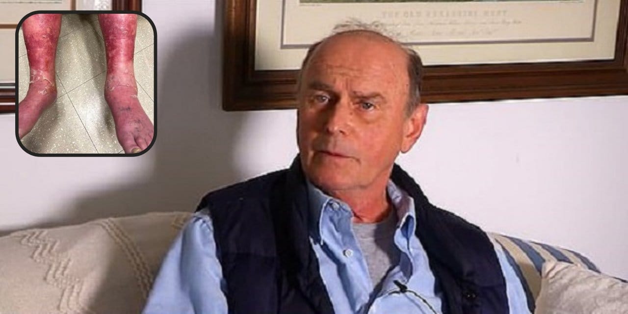 ABD'de Johnson&Johnson aşısı 'yan etki' skandalı