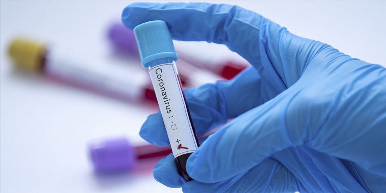 Koronavirüs testlerinin pozitiflik oranında korkutan artış