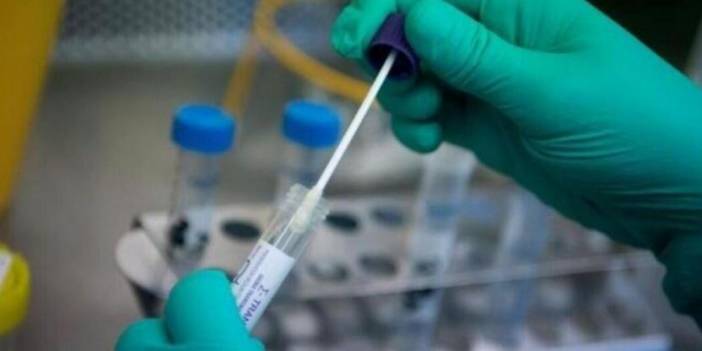 Sahte PCR testi hazırlayan çeteye 1 yıldan 39 yıla kadar hapis istemi