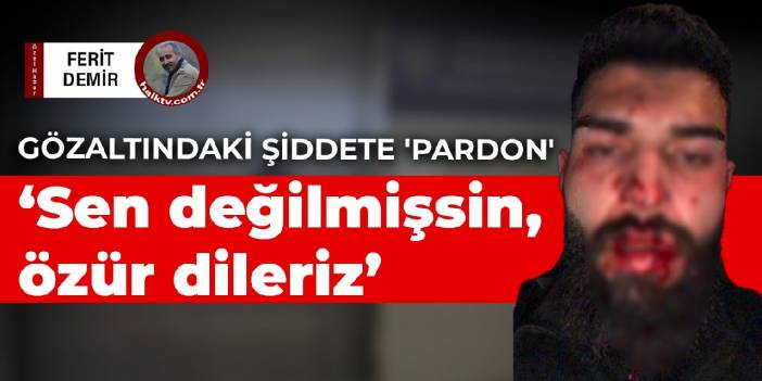 Gözaltındaki şiddete 'Pardon, sen değilmişsin, özür dileriz'