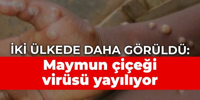 İki ülkede daha görüldü: Maymun çiçeği virüsü yayılıyor