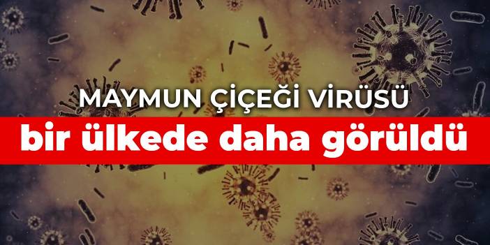 Maymun çiçeği virüsü bir ülkede daha görüldü