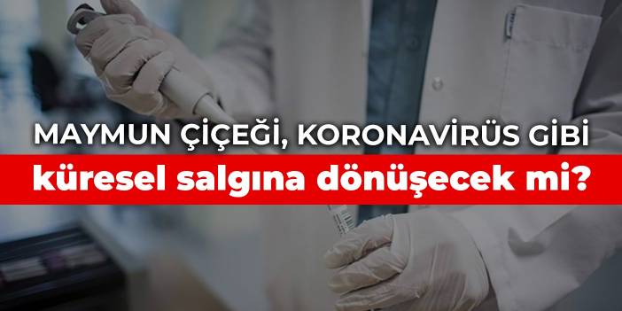 Maymun çiçeği, koronavirüs gibi küresel salgına dönüşecek mi?